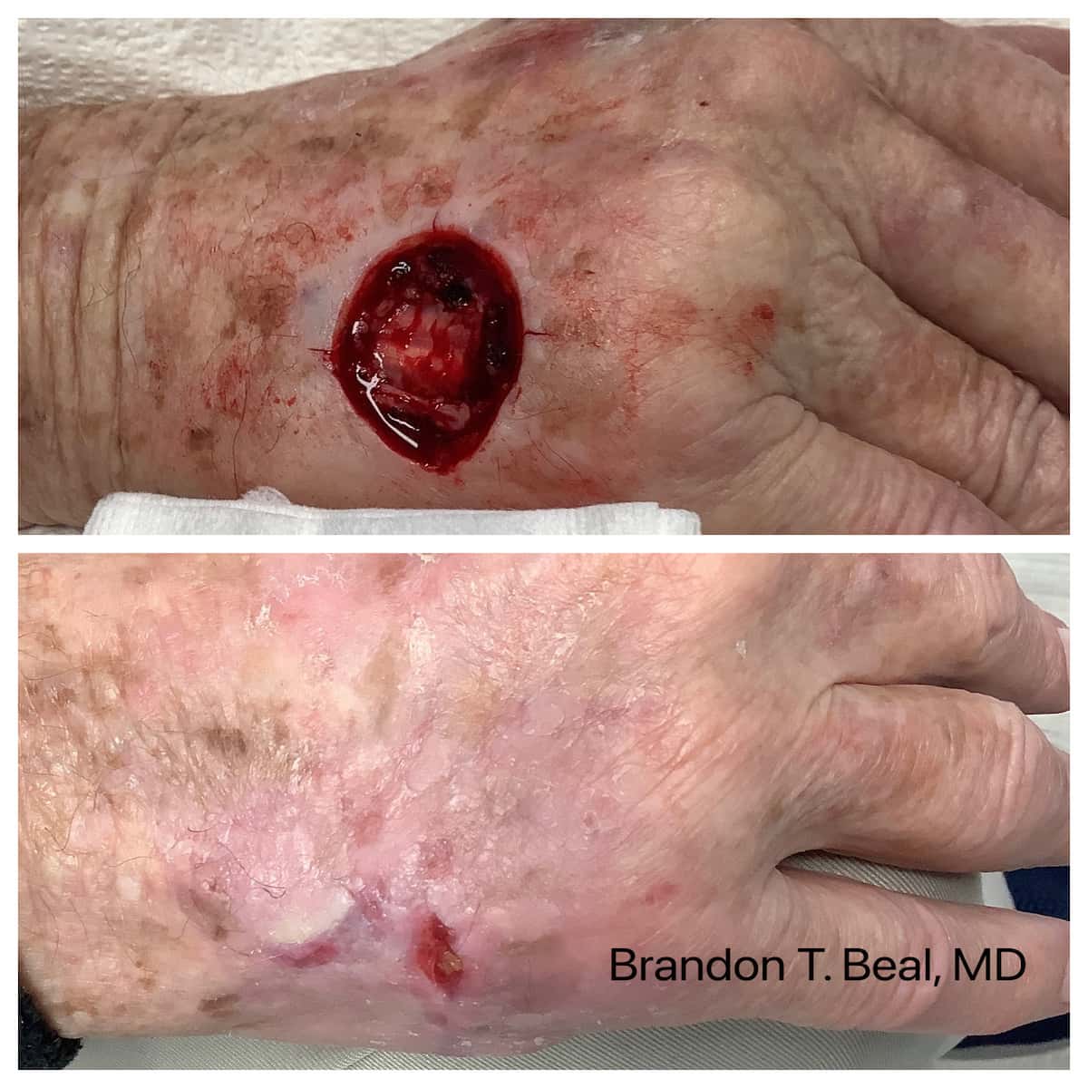 hand-surgery-before-and-after